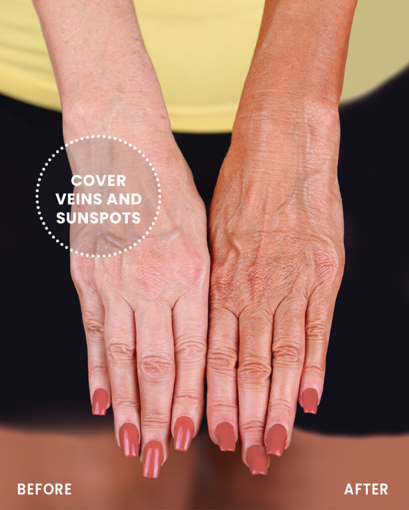 Cover Veins and Sunspots on Hands