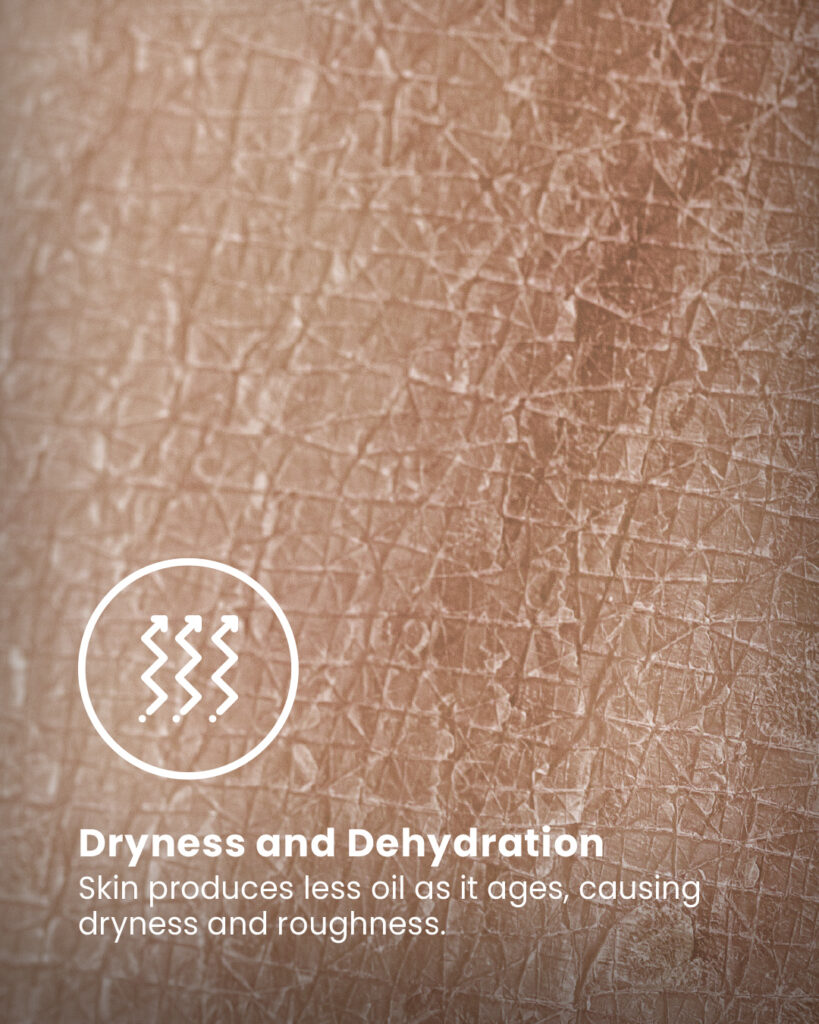 Dryness and Dehydration