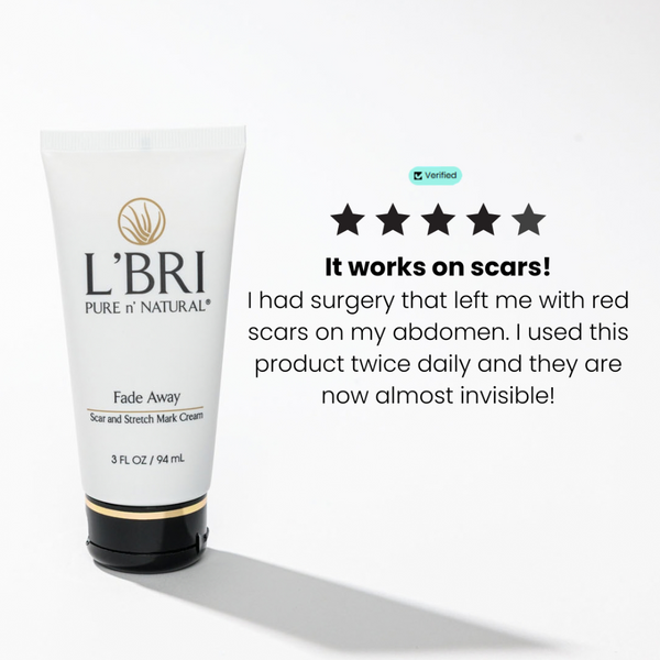 Fade Away Scar and Stretch Mark Cream